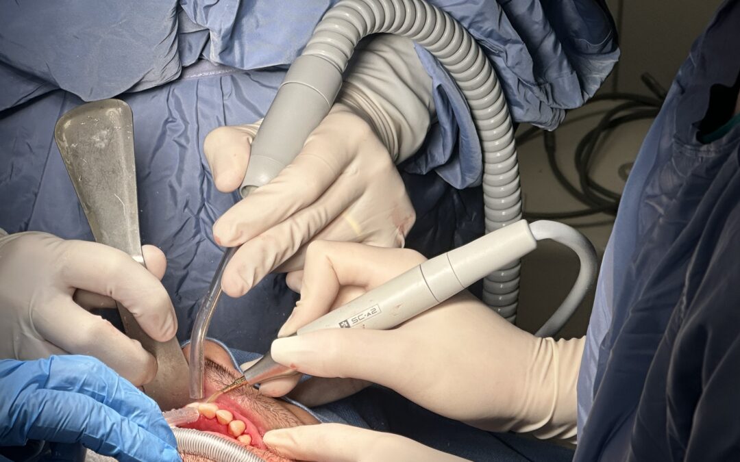 Pulizia dei Denti senza Dolore in Anestesia Totale