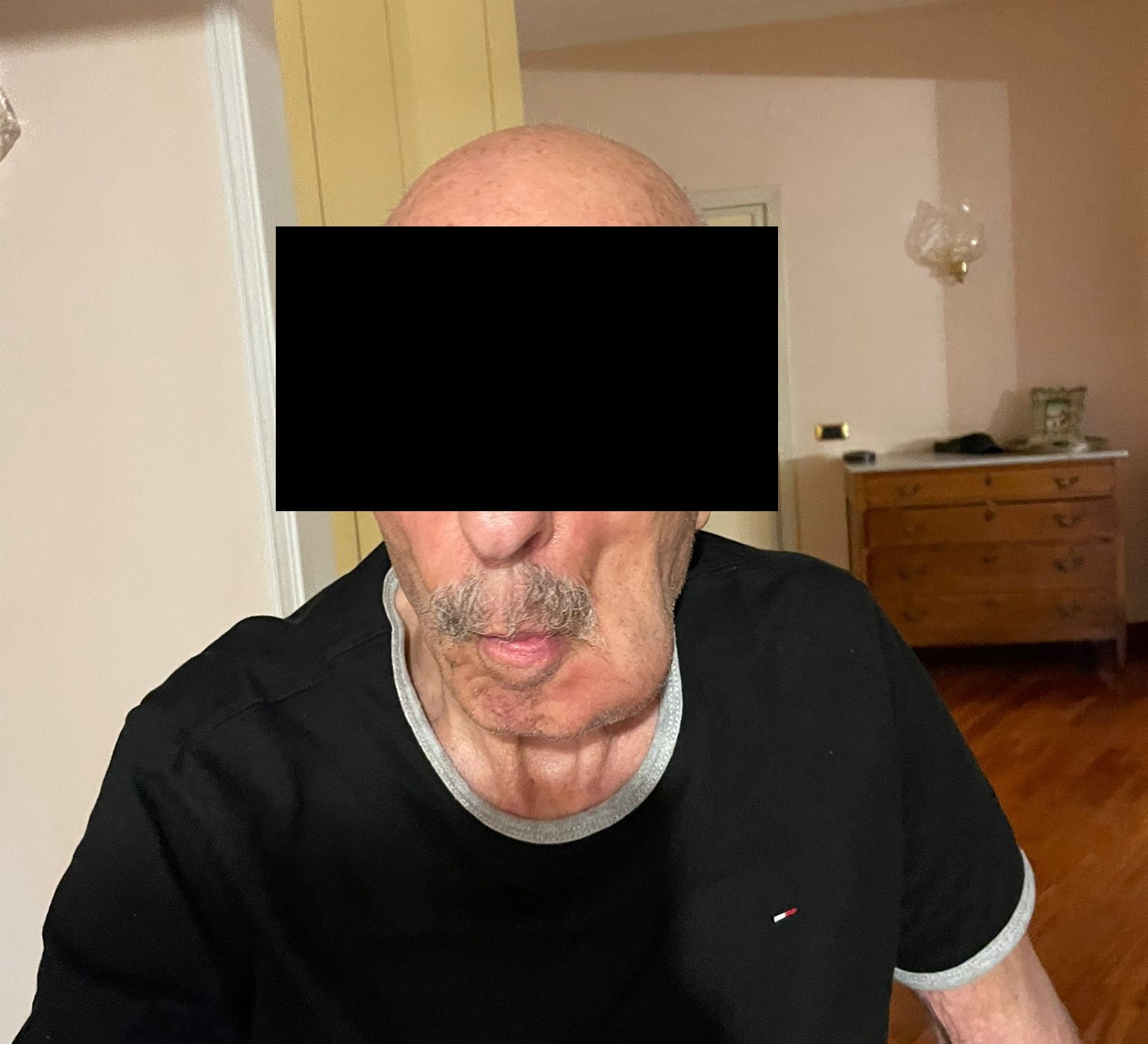 Ascesso Dentale Anziano non Collaborante