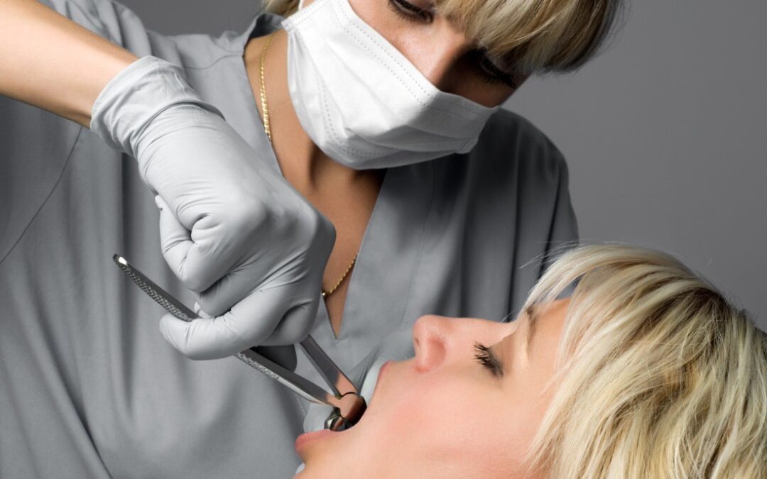 Estrazione denti: costi e modalità a Roma, Milano e Torino