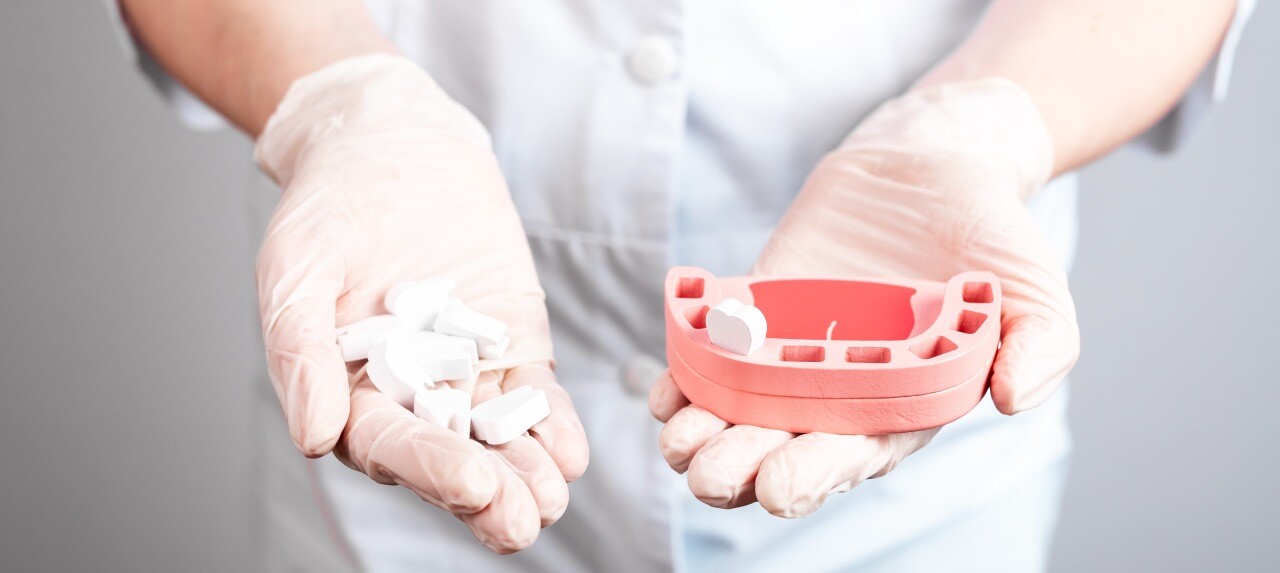 Estrazione Denti in Anestesia Generale Estrazione Denti in Anestesia Generale