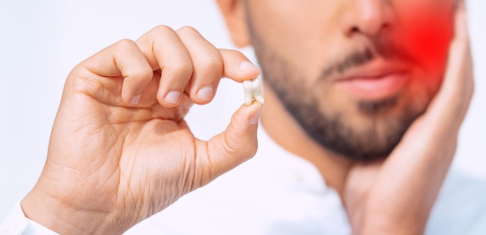 Estrazione Denti in Anestesia Totale: tutto ciò che devi sapere