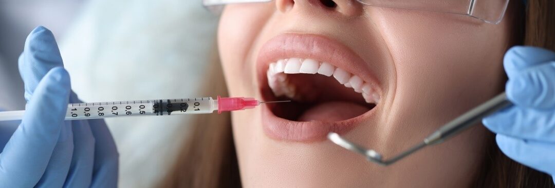 Anestesia Dentale per Pazienti con Reazioni Allergiche