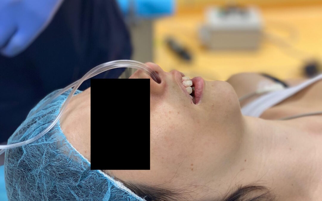 Sedazione cosciente, sedazione profonda o anestesia generale dal dentista?